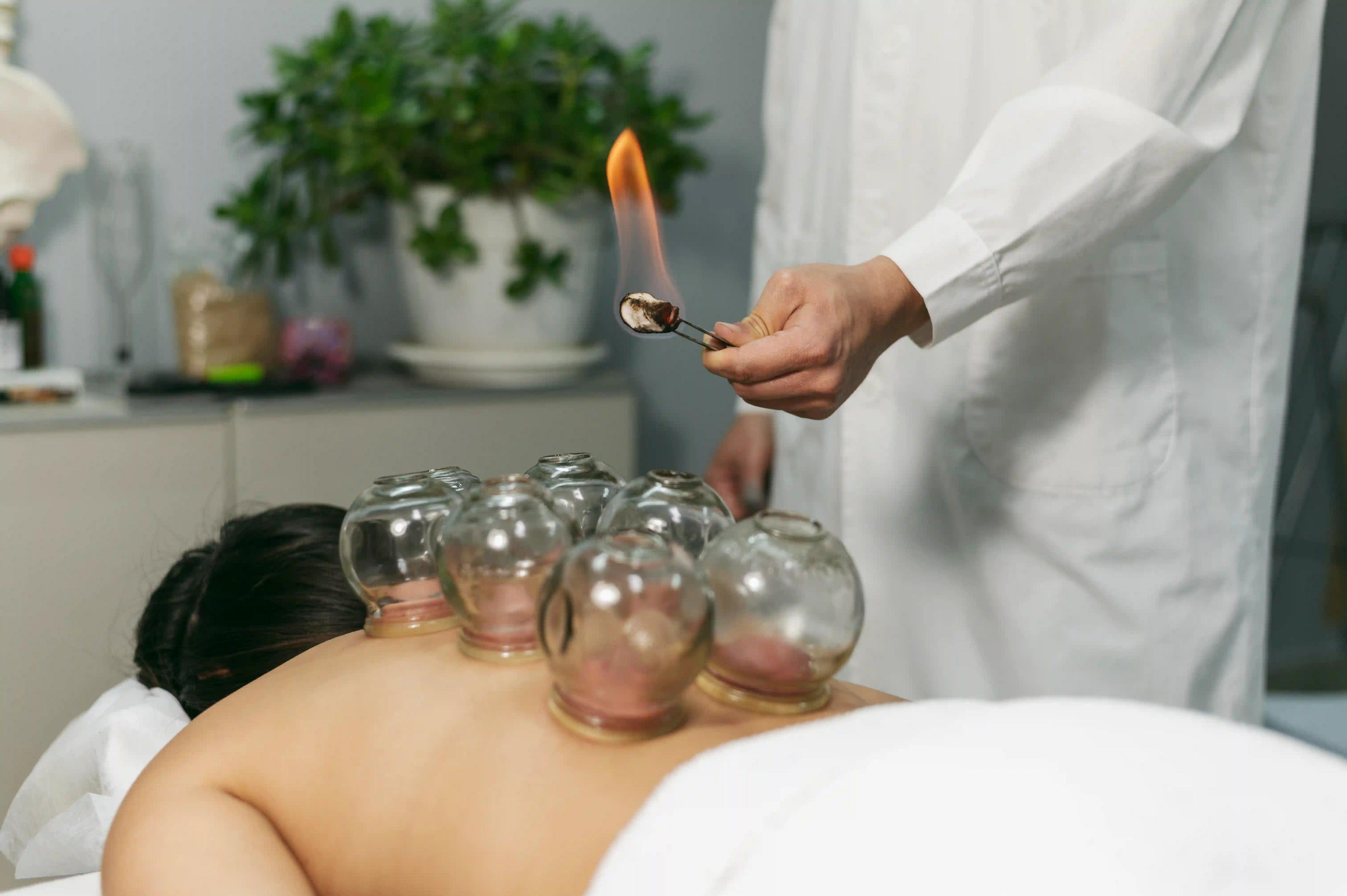 Cupping Therapy  | Mount Heaven Spa